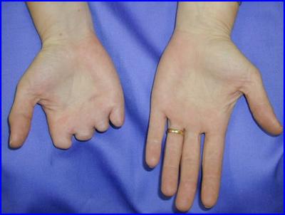 Dysfunkcje ortopedyczne a prawo jazdy